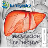 Inflamación del hígado