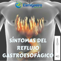 Síntomas del reflujo gastroesofágico
