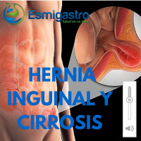 Hernia Inguinal y Cirrosis