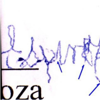 Cerebro y Pericia Caligráfica II