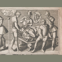 When a Hole in the Head is a Good Thing