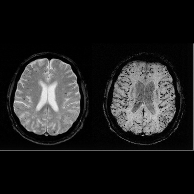 Distillations: Science + Culture + History