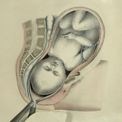 Distillations: Science + Culture + History