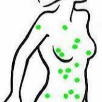 Carga Tóxica o Body burden