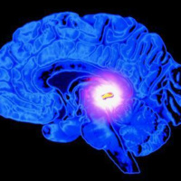 D13: The Pineal Gland