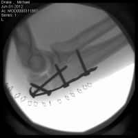 Ep 42 - Painful Lessons on the Nose of El Capitan - Mike Drake