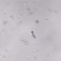 Nanoroboter-Befruchtung (freiwillig?)