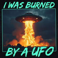 I Was Burned by a UFO