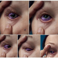 Dr. Setareh Ziai, assistant professor of ophthamology at the University of Ottawa Eye Institute - September 29th 2017