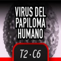 T2C6 - VPH Virus del Papiloma Humano