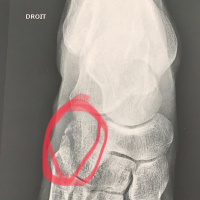 151: Injury and Insult