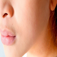 ¿Cuál es la causa de los jiotes?