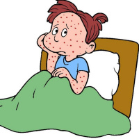 La verdad sobre el sarampión