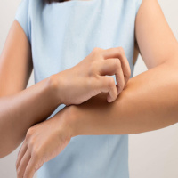 Que es la tiña, diagnóstico y tratamiento