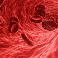 Anemia aplásica, sinónimo de muerte