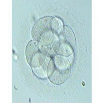 Adopción De Embriones