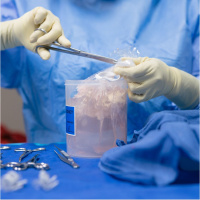 Close Calls and Skipped Lines: The Fraught State of Organ Donation