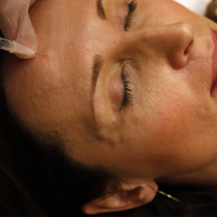 Plastikkirurgi och trender