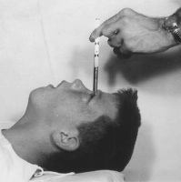 SPECIAL: Remembering Howard Dully of My Lobotomy