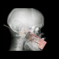 Skeptic Check: Cell Phone Danger