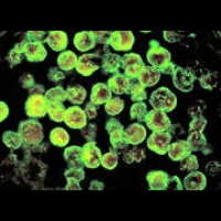 Blame it on Bacterio