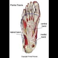 Injury Series: Plantar Fascia Pain