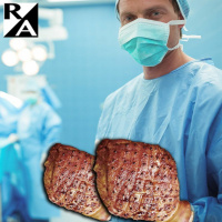 Ham-Handed Surgeons