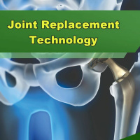 Joint Replacement Technology - Episode 290