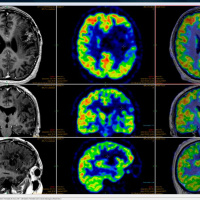 Medical Imaging Technology - Episode 58