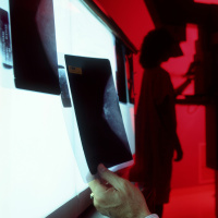 Cancer Screening: Are we harming the healthy?