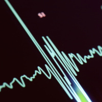 Five ways your heart can kill you that you did not know