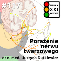 #117 - Porażenie nerwu twarzowego