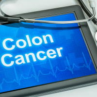 Colorectal Cancer: 5 Facts to Know