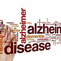 Alzheimers Disease: 6 Facts to Know