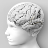 How does a brain implant affect your mind?