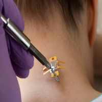 Human Organs-on-Chips