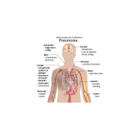 Marks Diary: Happy Pneumonia New Year