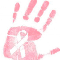 ¿Cómo prevenir el Cáncer de Mama?