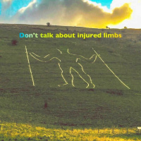 Dont talk about injured limbs