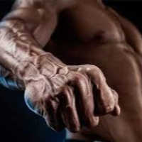 Los Danko 15x16 - Varices en los Bíceps