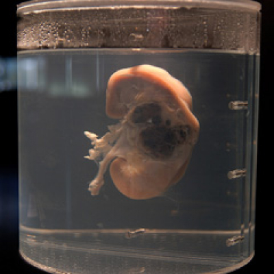 En Riguroso Diferido