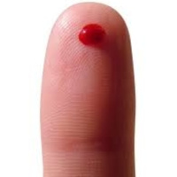 El fraude de Theranos y Elizabeth Holmes