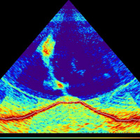 The birth of a new volcano