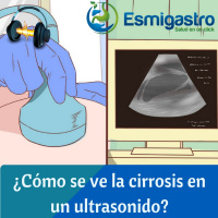 114 - ¿Cómo se ve la cirrosis en el ultrasonido?
