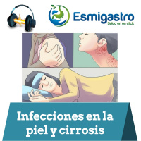108 - Infecciones de la piel y cirrosis