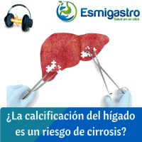 116 - Calificaciones en el hígado ¿es cirrosis?