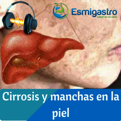 Asesoría Para Pacientes Con Enfermedades Hepáticas