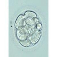 Vitrificación embriones. Tipos de embriones