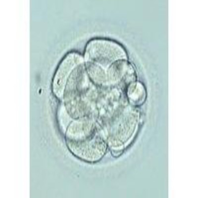 Vitrificación Embriones. Tipos De Embriones
