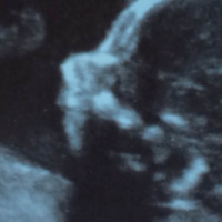 Åker till Finland för att ta reda på könet / Menevät Suohmeen othaan selvile lapsen sukupuolen